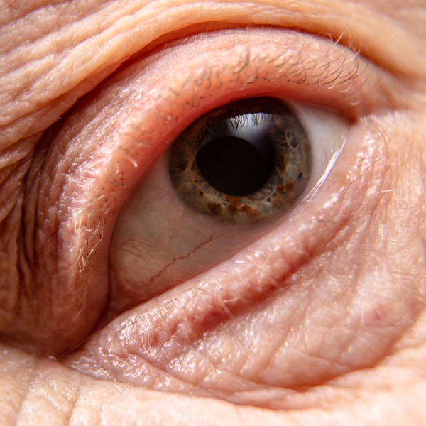 Augenlider, Augenarztpraxis Dres. Schwartzkopff in Lörrach